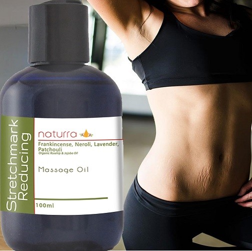 5 Essentials for Skin that is  Stretch-mark free after Weightloss